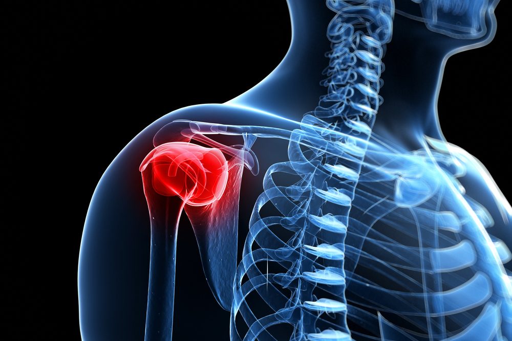 fájdalom a bal vállízület kenőcsében az 1 fokú csípőízület artrózisának kezelése